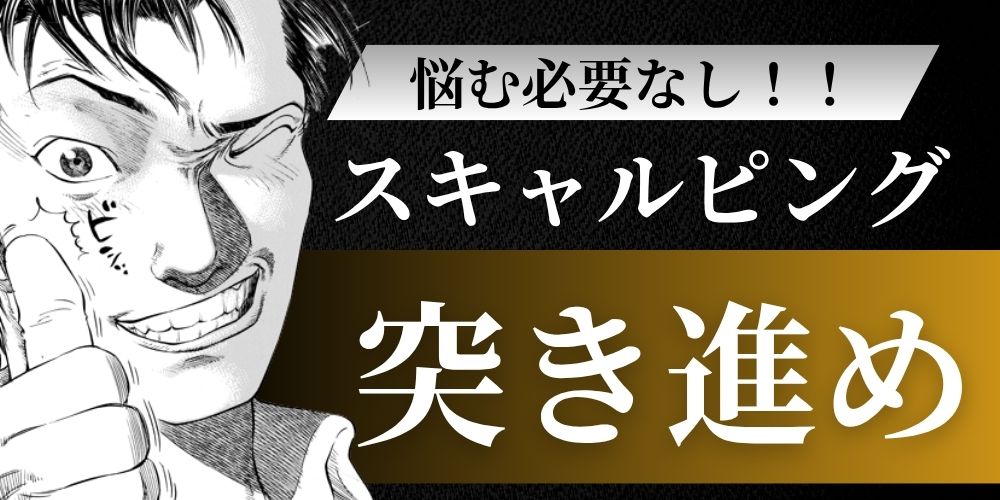 スキャルピングしか勝てない